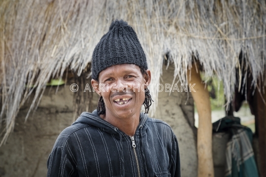 toothless African man