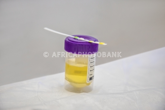 urine sample