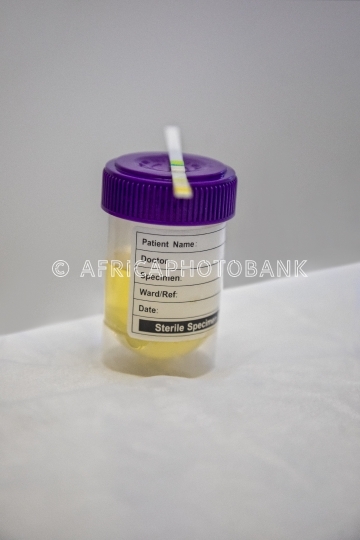 urine sample
