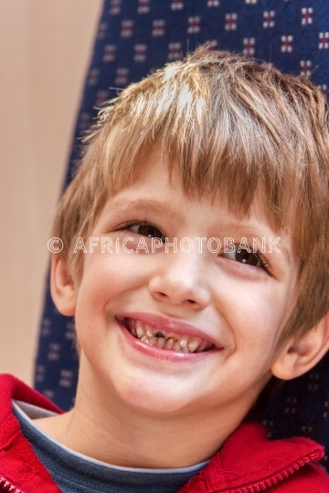 child with bad teeth