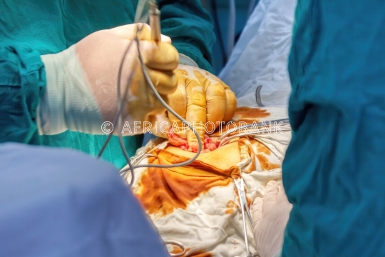 surgeon at work